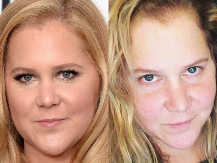 Amy Schumer